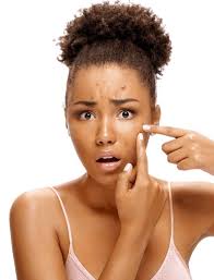 Bye Bumps, Hello Glow: The Pretty Melanin Guide to Every Type of Pimple”
