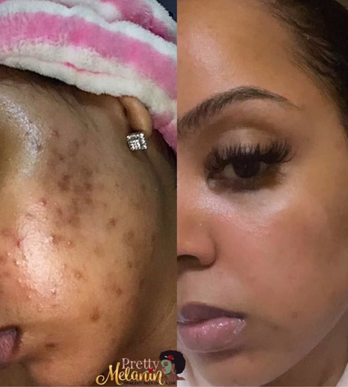 Even Tone Repair Cleanser (Hyperpigmentation, Dark Spots, Acne scars)