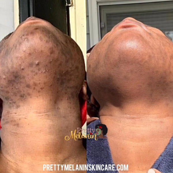 Customer review image