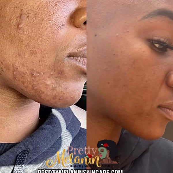 Customer review image