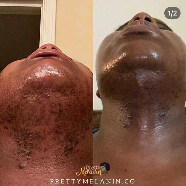 Customer review image