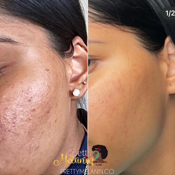 Customer review image