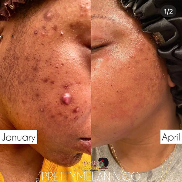Customer review image