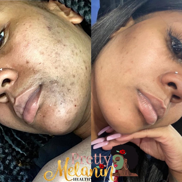 Customer review image