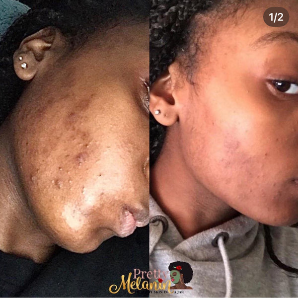 Customer review image