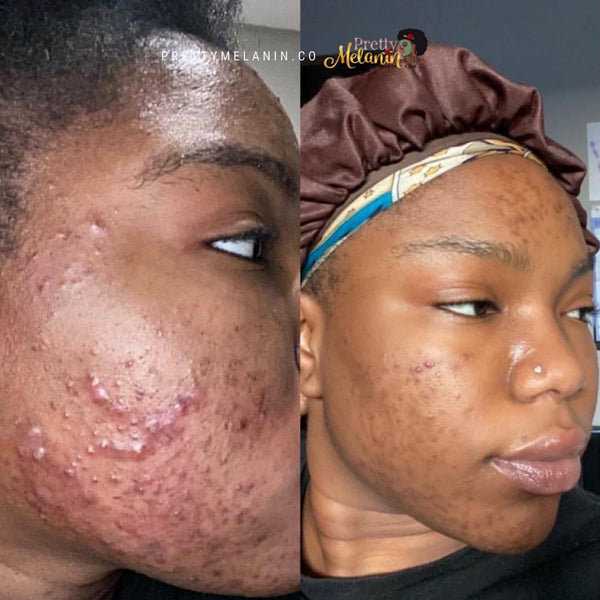 Customer review image