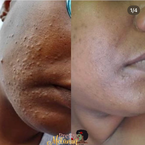 Customer review image